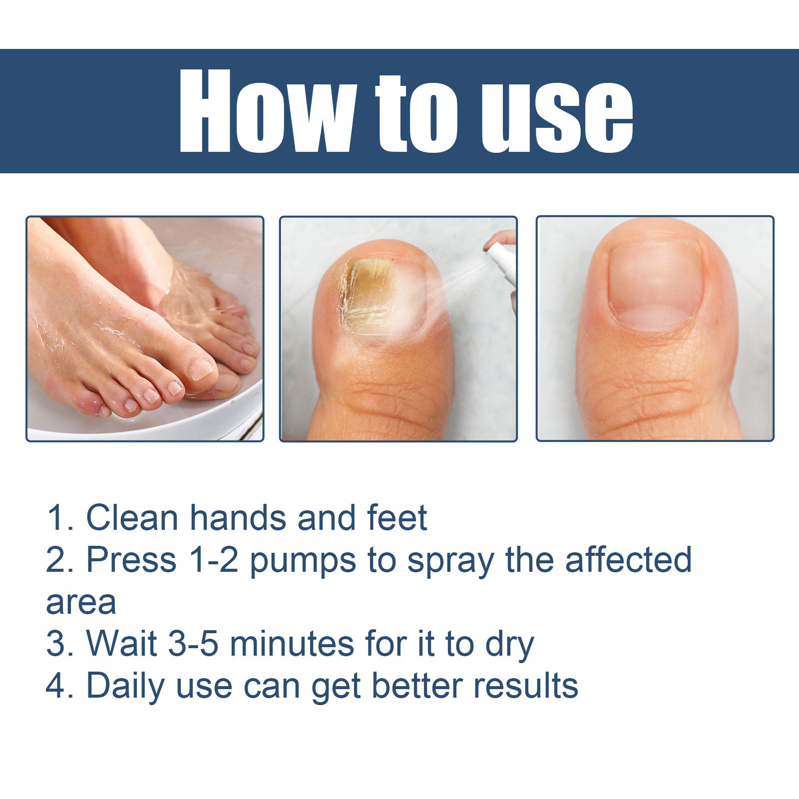 Nail Care Spray Gently Cleans Foot Nails Moisturizing And Brightening Nail Care Spray