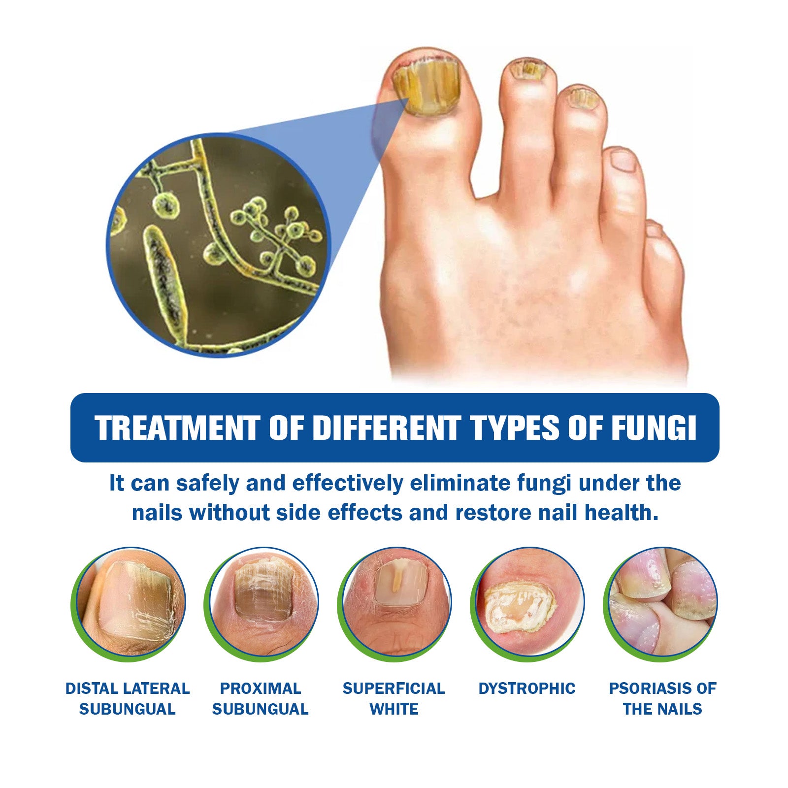 EOHOE Nail Care Instrument, Toenail Care Instrument, Soft Nail Care Instrument