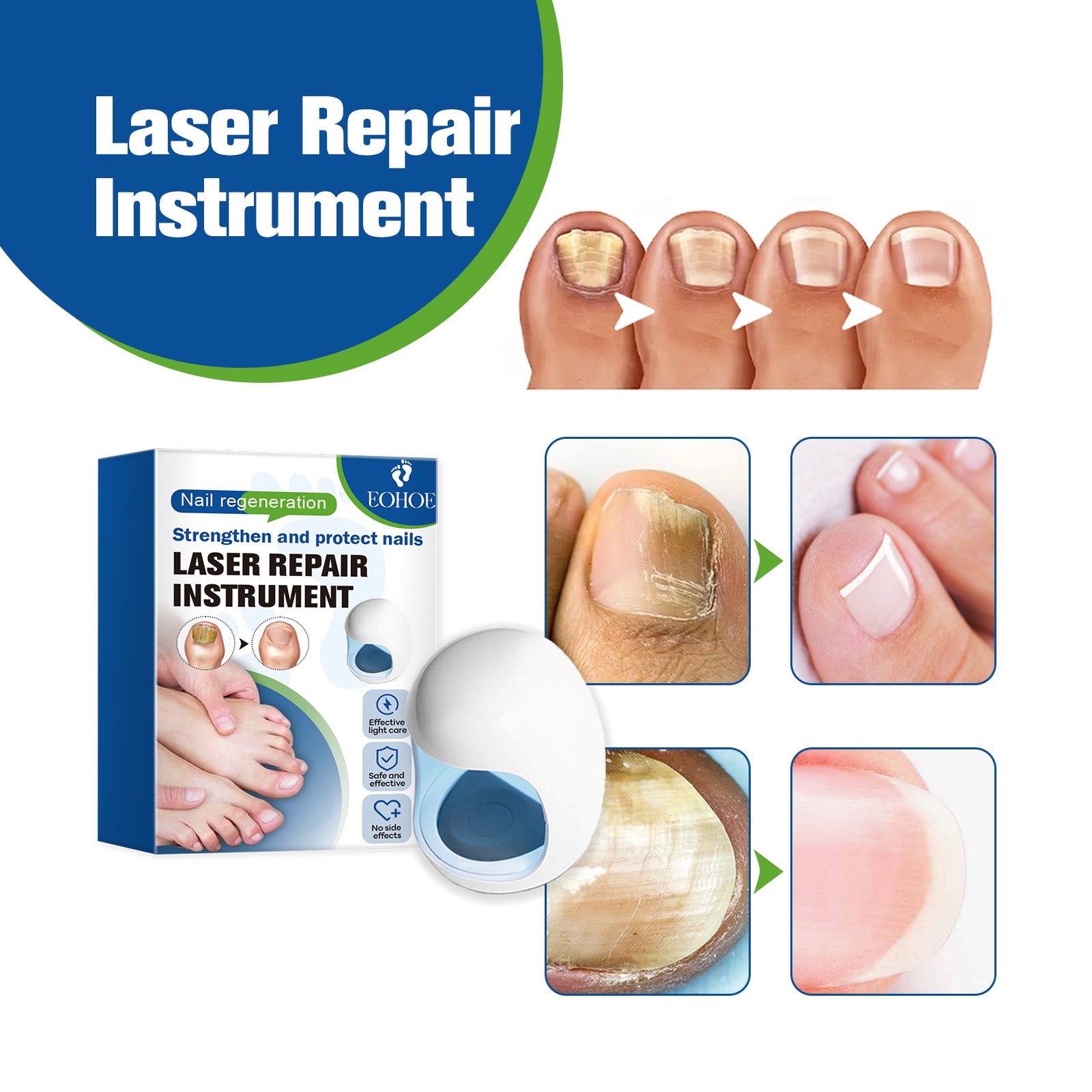 EOHOE Nail Care Instrument, Toenail Care Instrument, Soft Nail Care Instrument