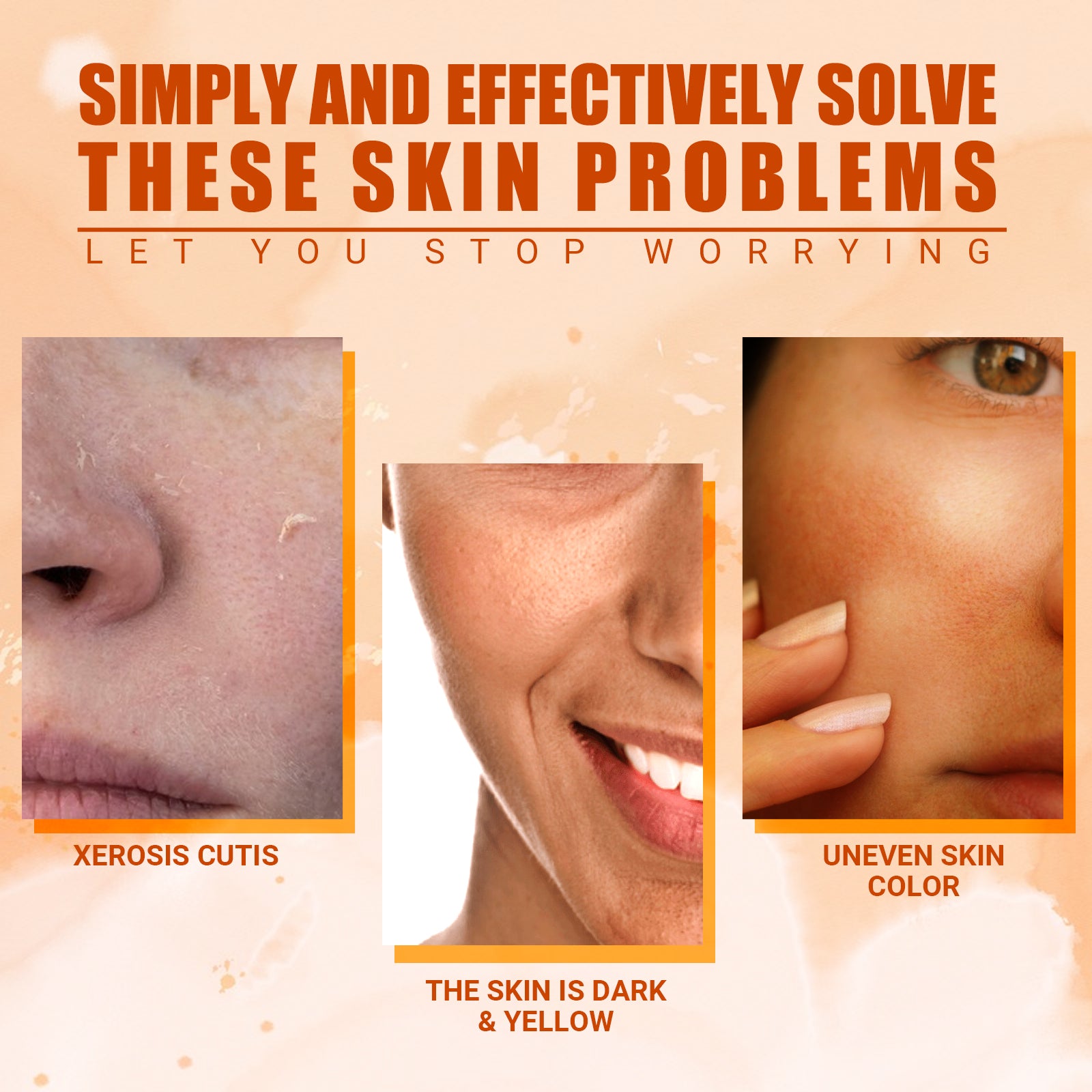 Vitamin C Moisturizing Spray Hydrates And Moisturizes Skin, Lightening Acne Spots And Whitening Spray