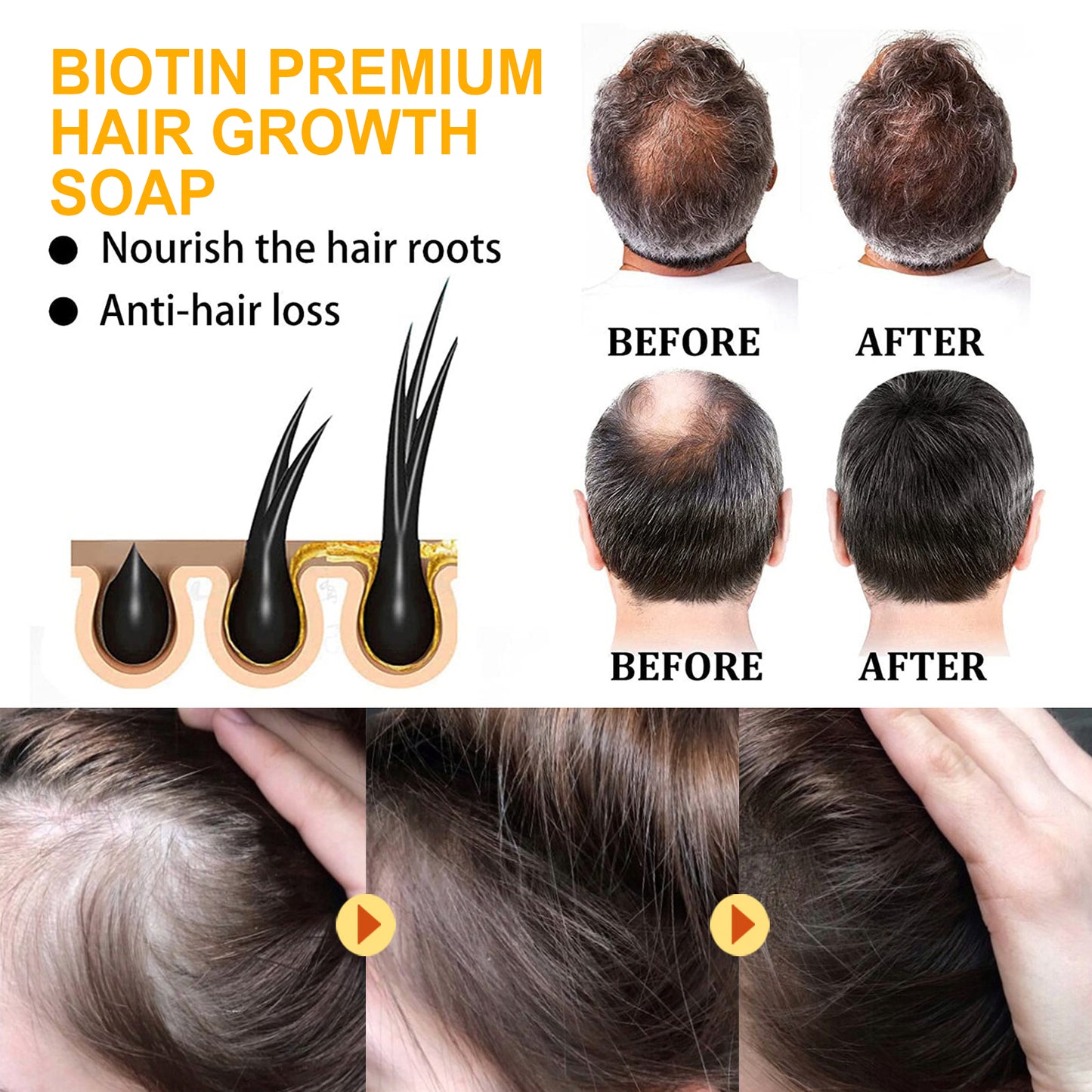 Biotin Premium Hair Growth Soap, Strong And Moisturizing Hair Root To Reduce Dryness Smooth Beautiful Clean Hair Soap