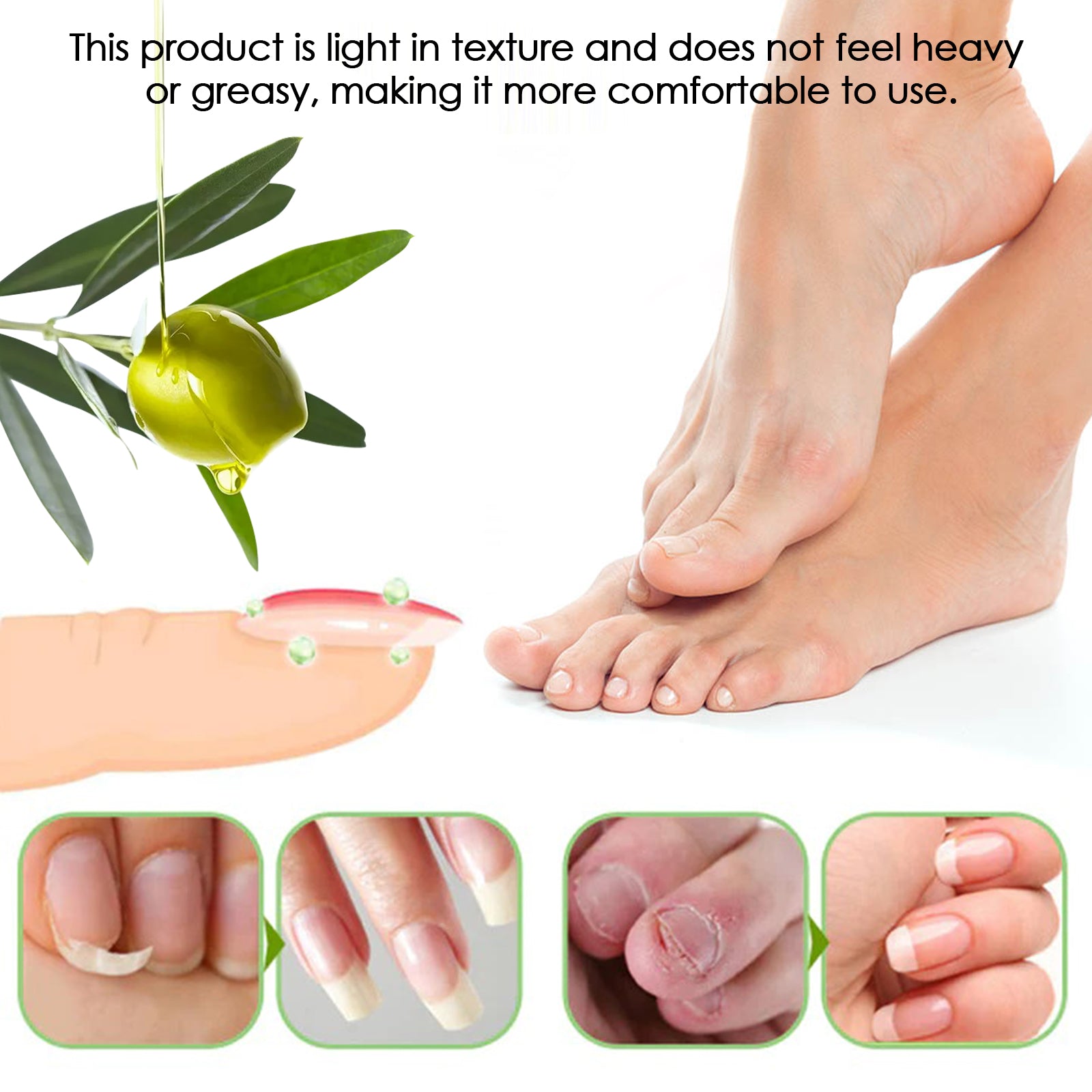 Cuticle Oil Pen, Moisturizing Nail Repair Nourishes And Removes Gray Nails And Brightening Nail Care Solution