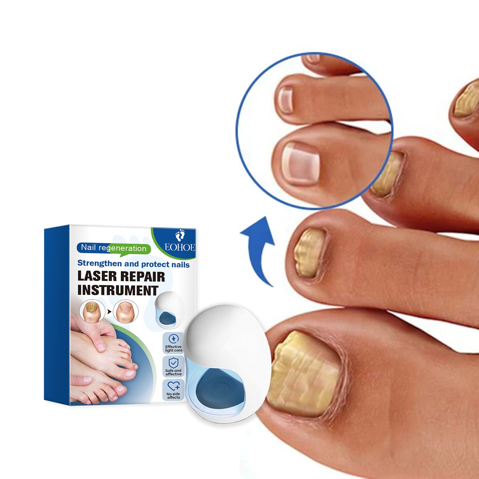 EOHOE Nail Care Instrument, Toenail Care Instrument, Soft Nail Care Instrument