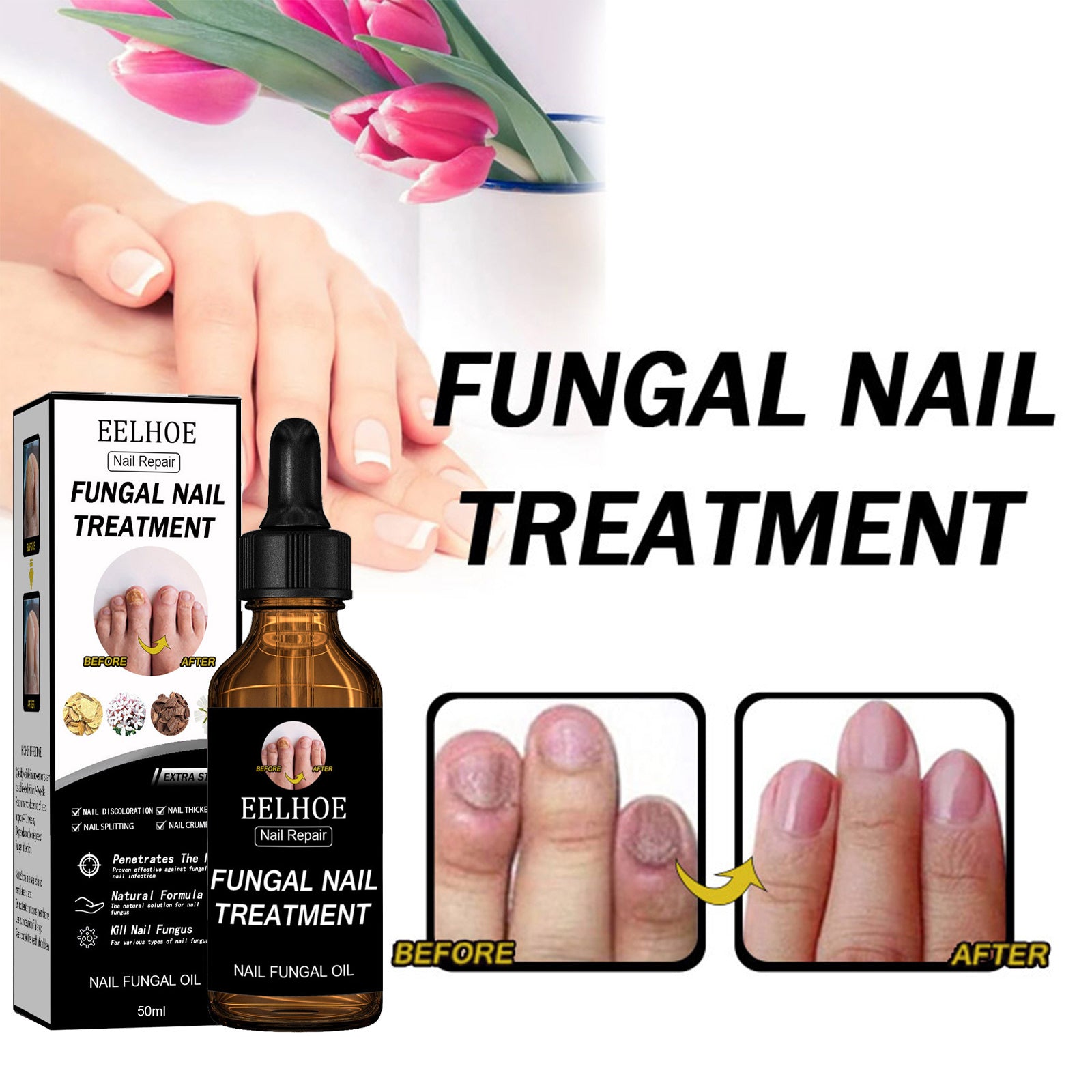 Nail Repair Solution Thickening Brightening Nails Removing Gray Nails Dead Skin Repair Nourishing Nail Care Solution