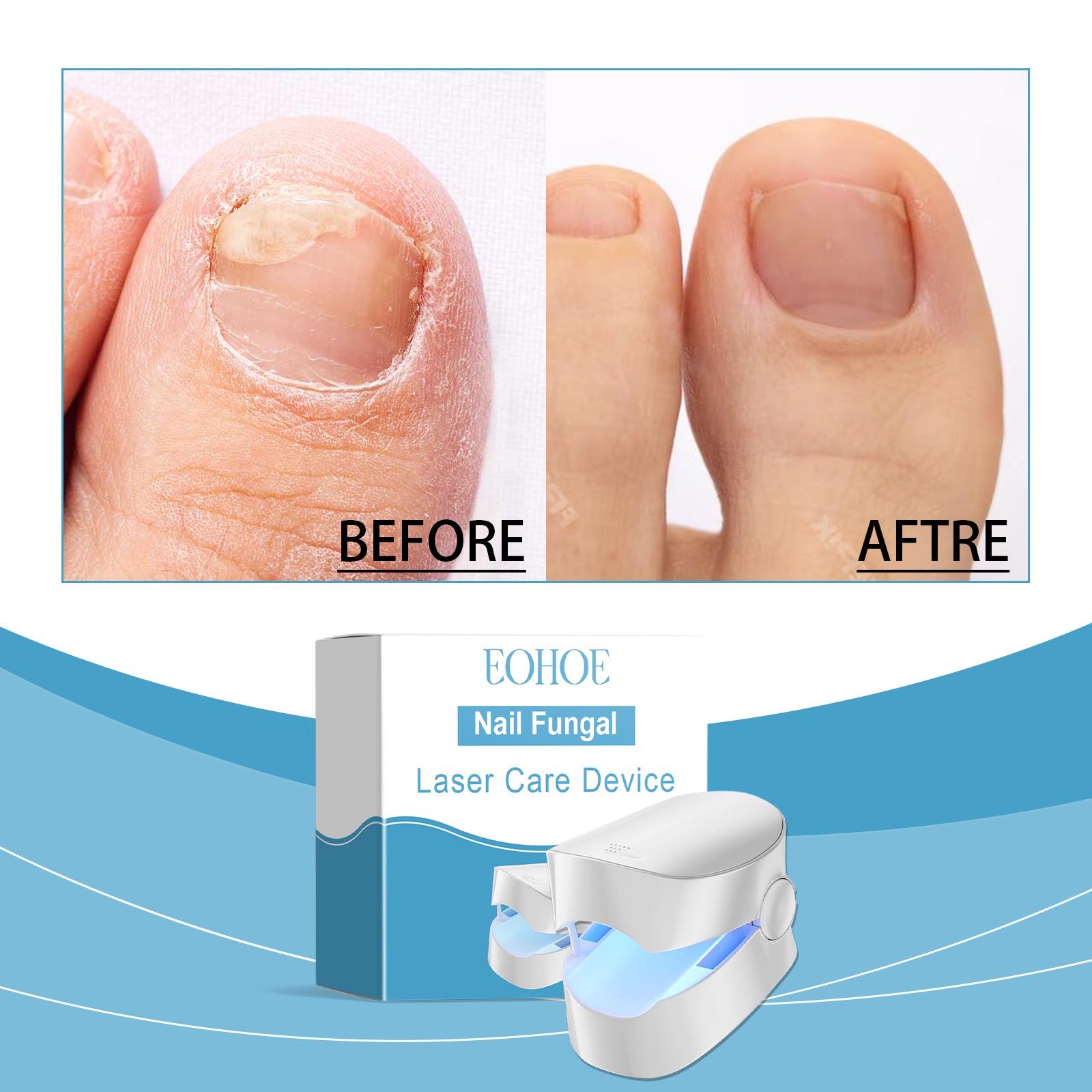 EOHOE  Nail Care Instrument, Nail Care Instrument Maintenance Instrument Daily Gentle Repair Strong Strong