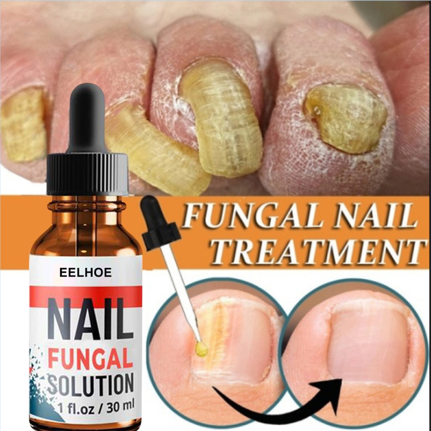Nail Repair Solution, Hand And Foot Gray Nail Care Repair Gray Nail Solution Thickening Soft Nails