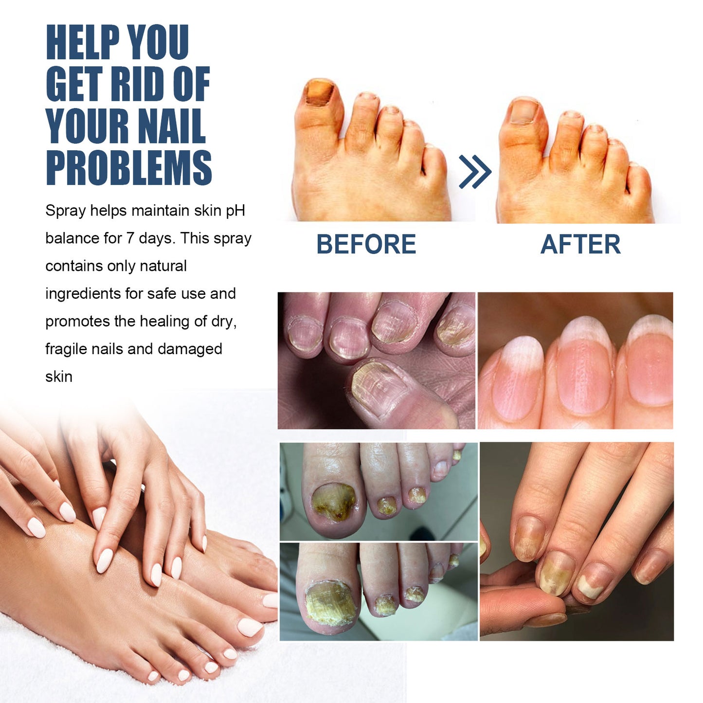 Nail Care Spray Gently Cleans Foot Nails Moisturizing And Brightening Nail Care Spray