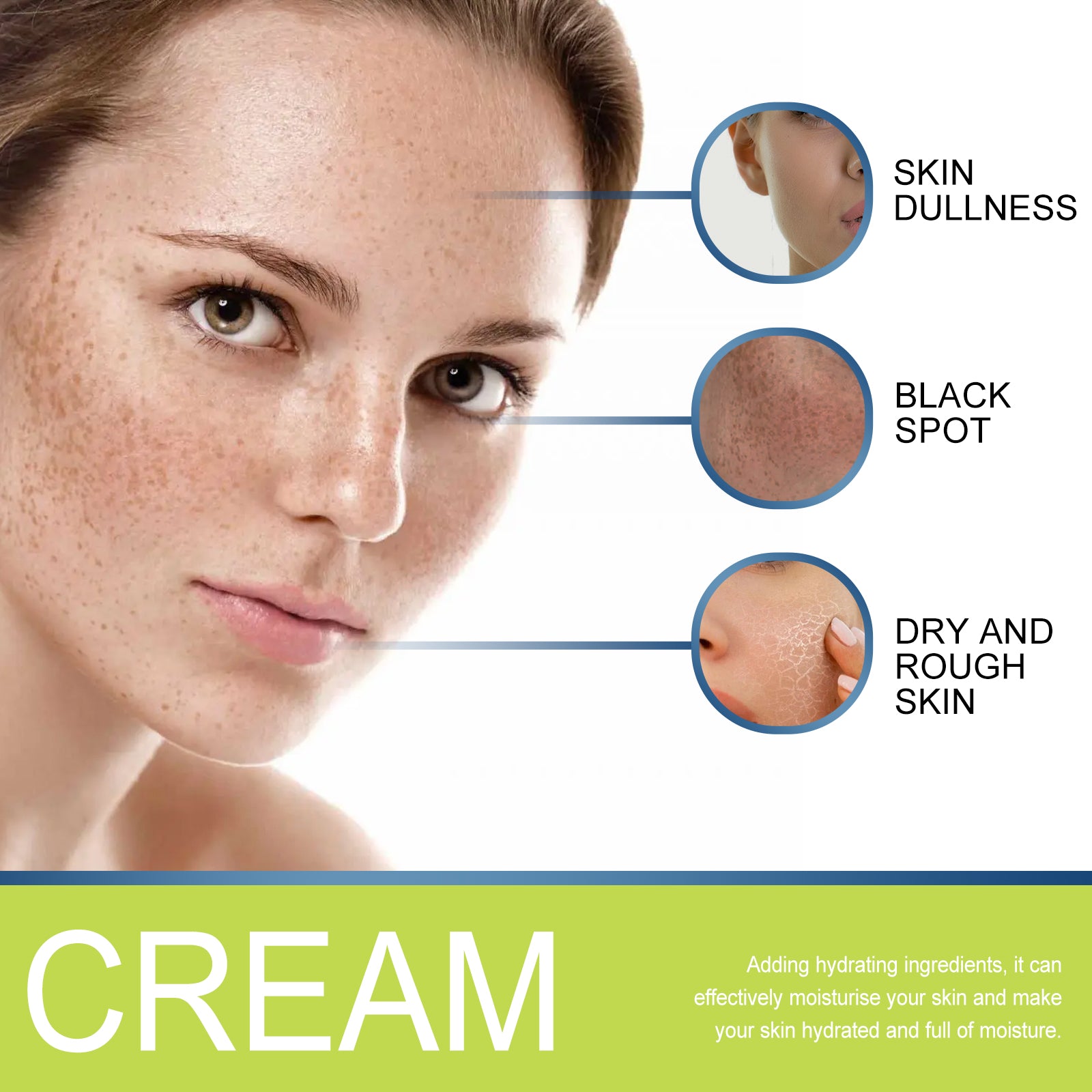 Correcting Cream, Brightening Skin Repair Freckle Melasma Age Spot Repair Cream