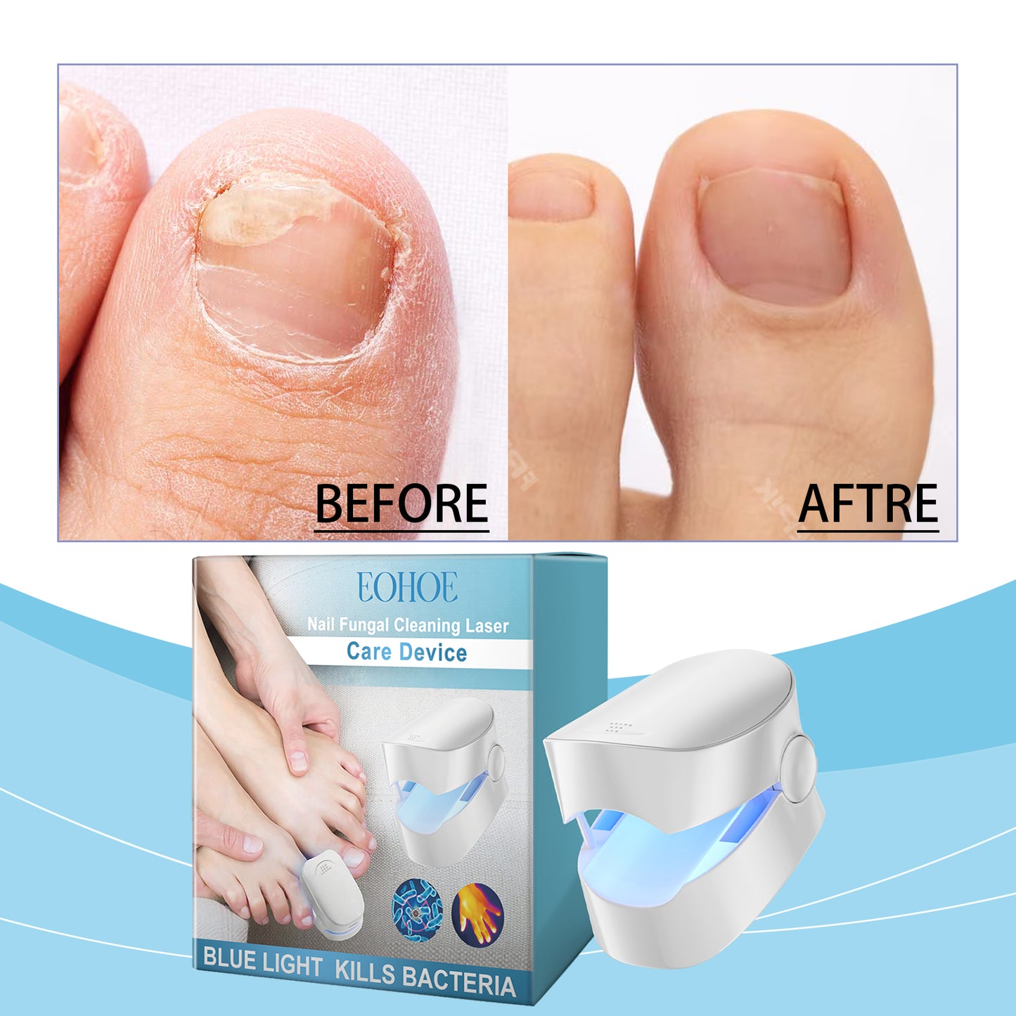 EOHOE Nail Care, Nail Cleaning Care To Relieve Discomfort On The Foot Of The Nail Smooth Rough Surface Of The Nail