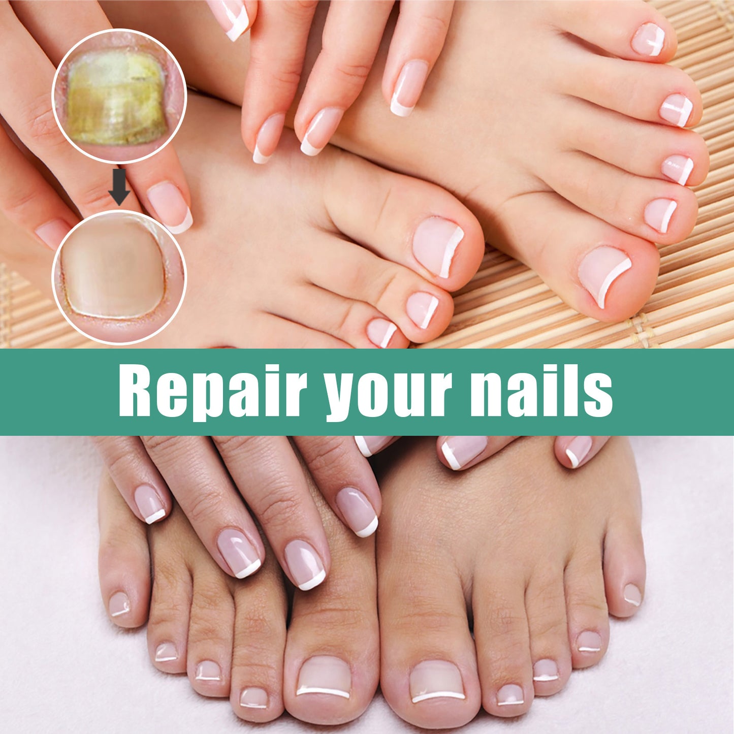 EELHOE Herbaceous Nail Relief Essence, Hand And Foot Nail Soft Thickening Brightening Nail And Bump Nail Care Solution